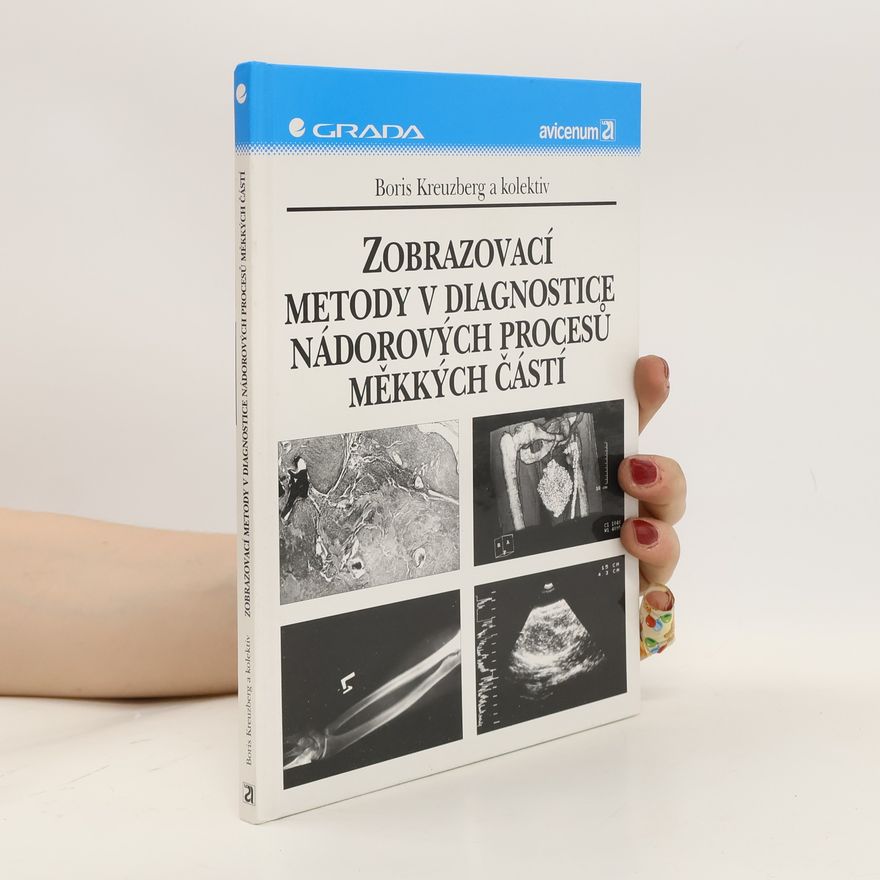 Boris Kreuzberg Zobrazovací metody v diagnostice nádorových procesů měkkých částí