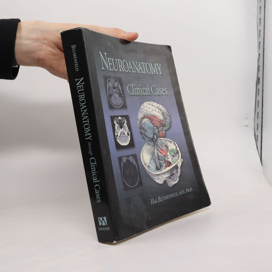 Hal Blumenfeld Neuroanatomy through clinical cases
