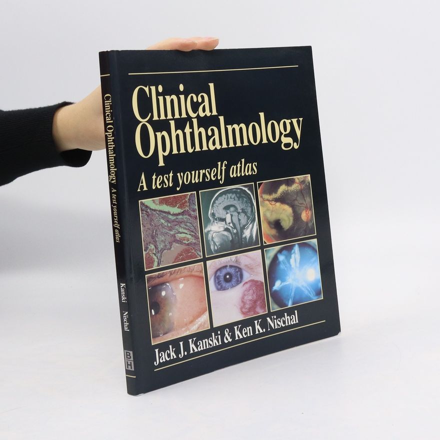 Jack J. Kanski Clinical Ophthalmology