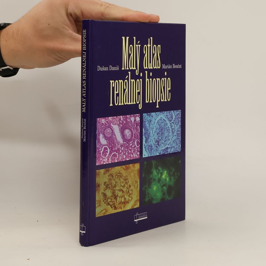 Marián Benčat Malý atlas renálnej biopsie