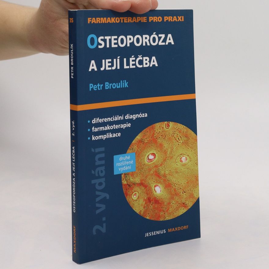 Petr Broulík Osteoporóza a její léčba: průvodce ošetřujícího lékaře