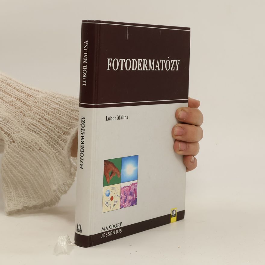 Lubor Malina Fotodermatózy
