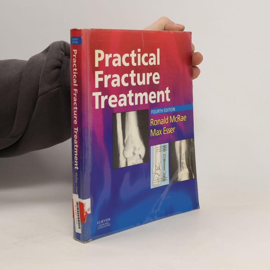 Max Esser Practical fracture treatment