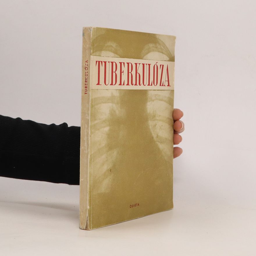 Autorenkollektiv Tuberkulóza