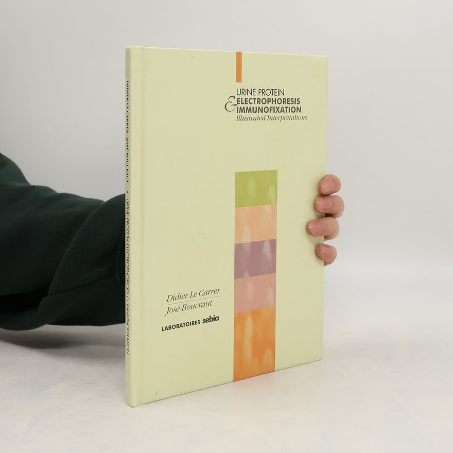 José Boucraut Urine Protein Electrophoresis and Immunofixation