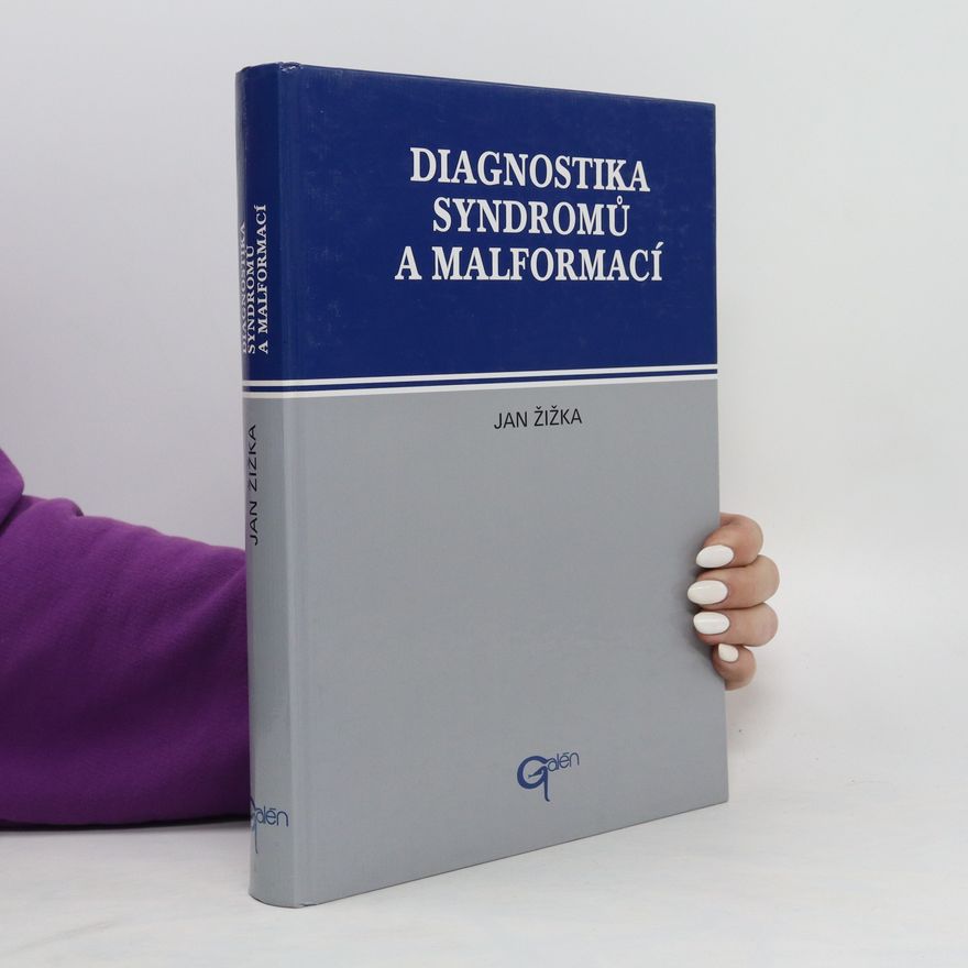 Eva Semanová Diagnostika syndromů a malformací
