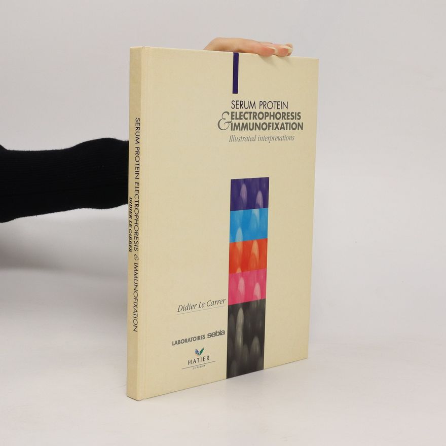 Didier Le Carrer Serum Protein Electrophoresis & Immunofixation