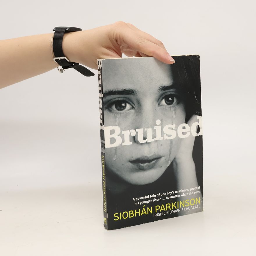 Siobhán Parkinson Bruised