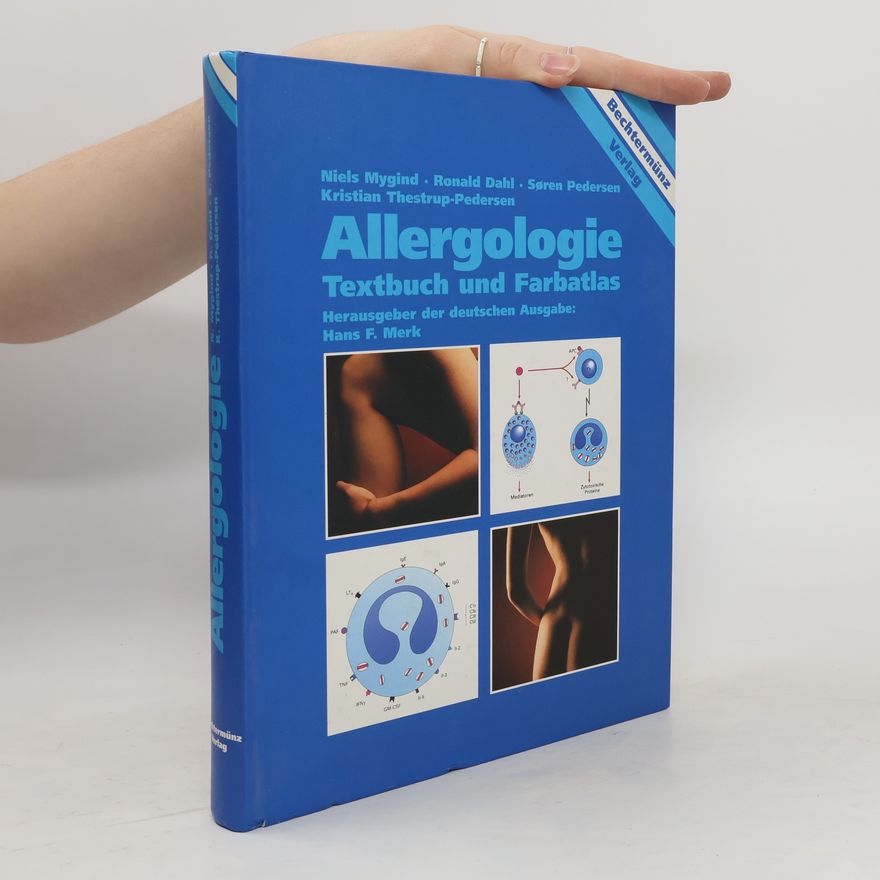 Niels Mygind Allergologie