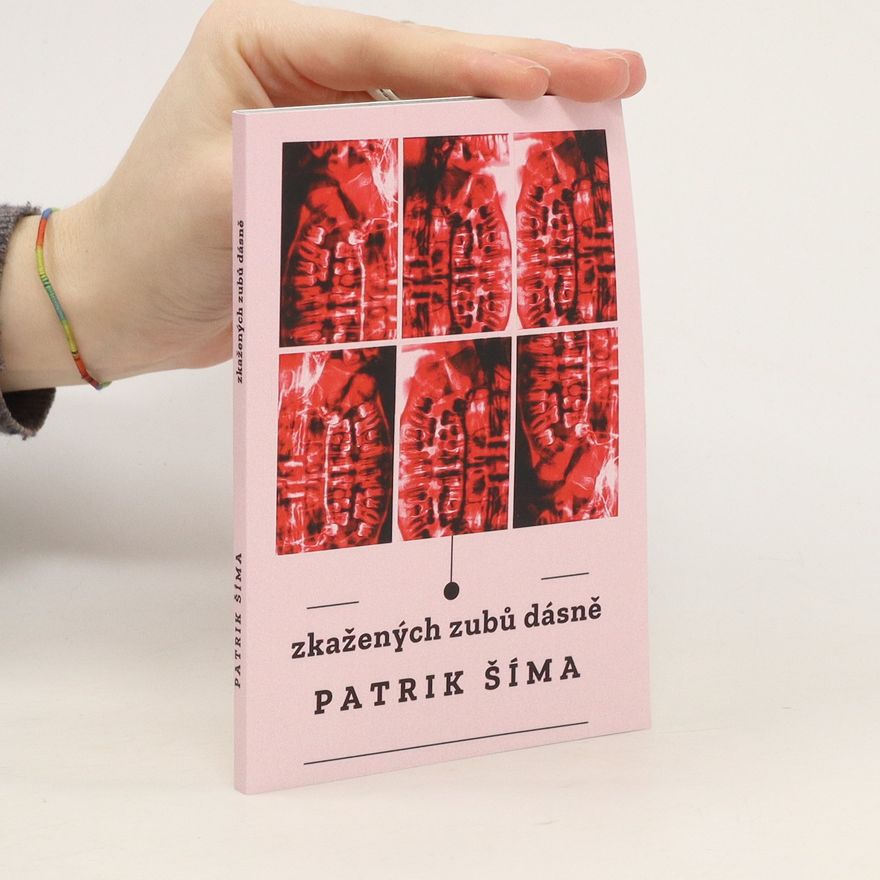 Patrik Šíma Zkažených zubů dásně