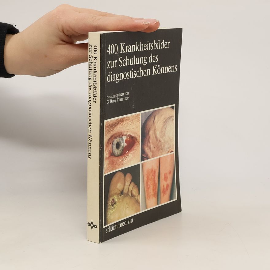G. Barry Carruthers 400 [Vierhundert] Krankheitsbilder zur Schulung des diagnostischen Könnens