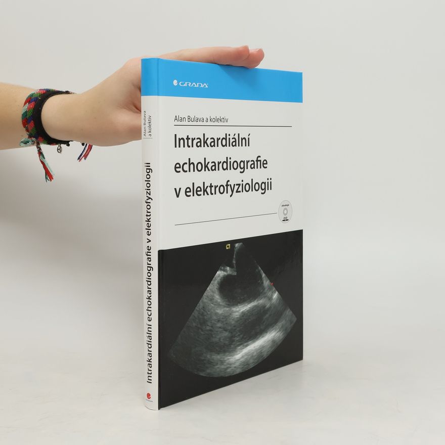 Alan Bulava Intrakardiální echokardiografie v elektrofyziologii