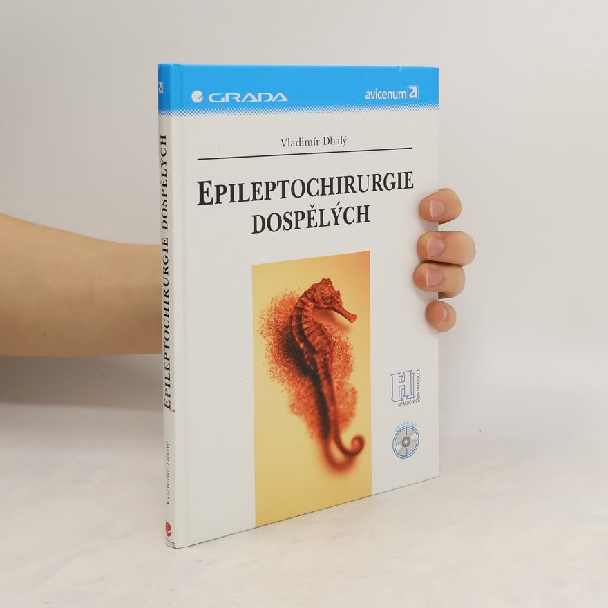 Vladimír Dbalý Epileptochirurgie dospělých
