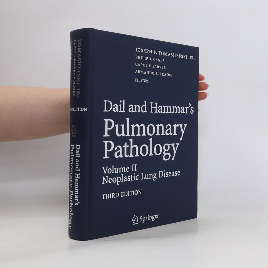 Carol Farver Dail and Hammar's Pulmonary Pathology. Volume II