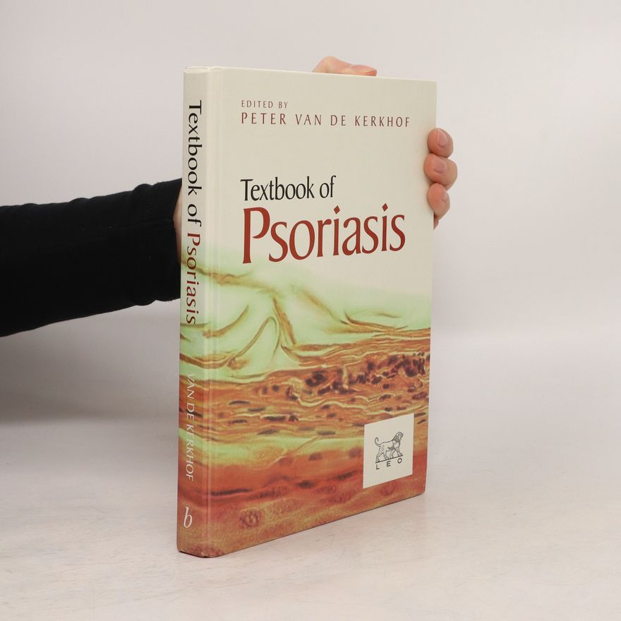 Petrus Cornelis Maria van de Kerkhof Textbook of psoriasis