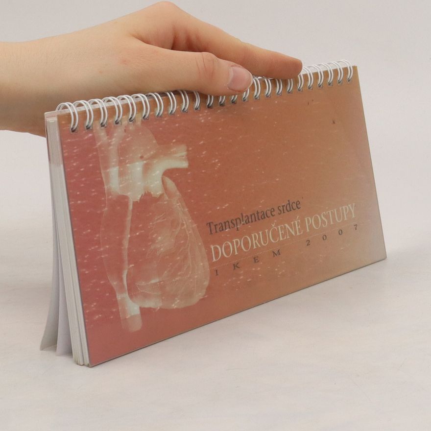 Kolektiv autorů Transplantace srdce