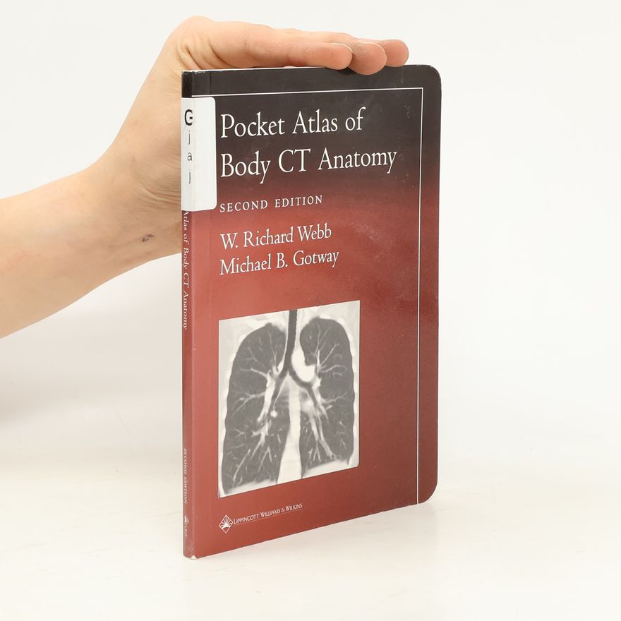 Michael B. Gotway Pocket Atlas of Body CT Anatomy
