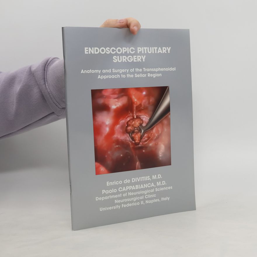 Kolektiv autorů Endoscopic Pituitary Surgery