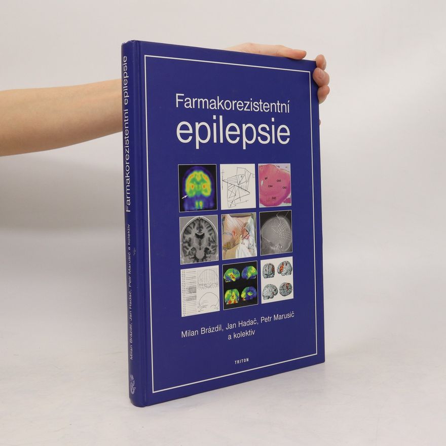 Kolektív autorov Farmakorezistentní epilepsie