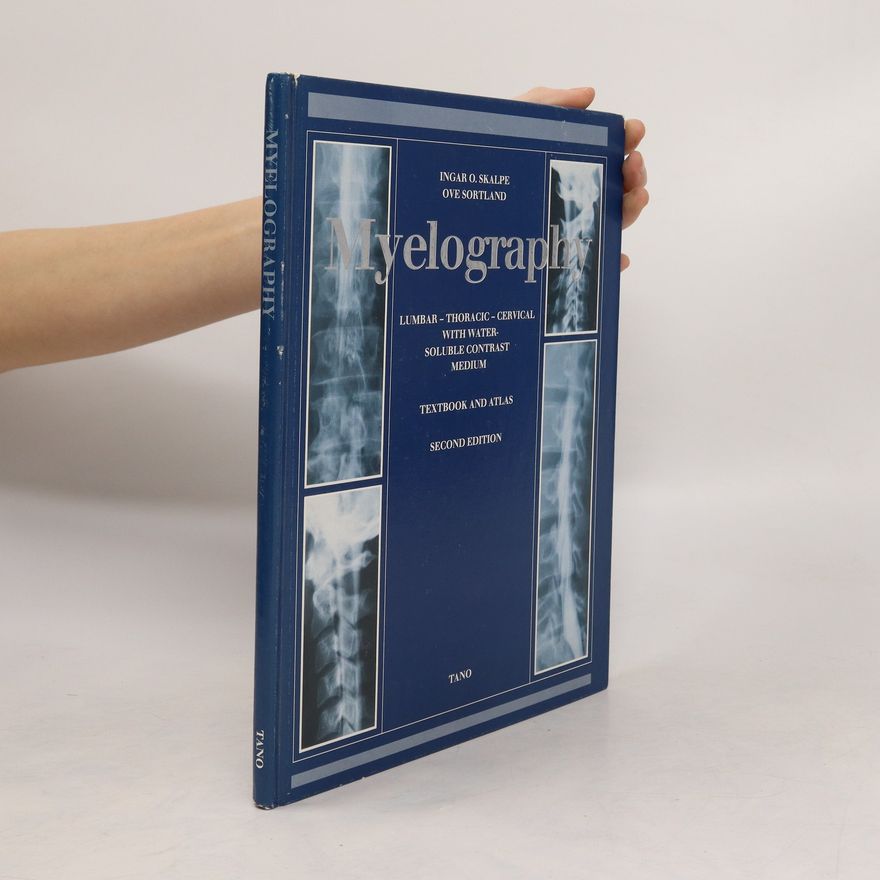 Ove Sortland Myelography