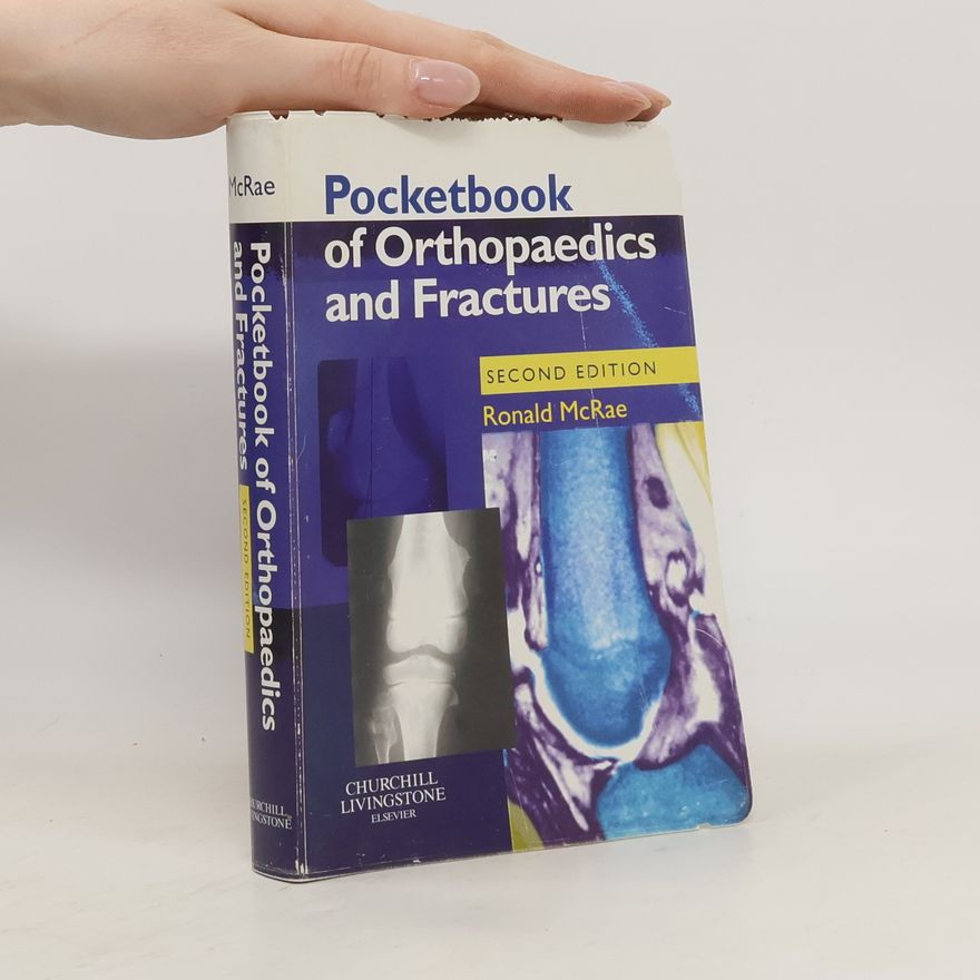 Ronald Mcrae Pocketbook of Orthopaedics and Fractures