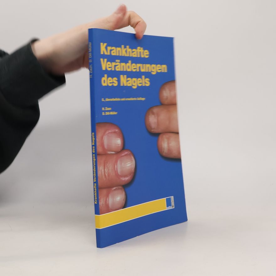 Hansotto Zaun Krankhafte Veränderungen des Nagels