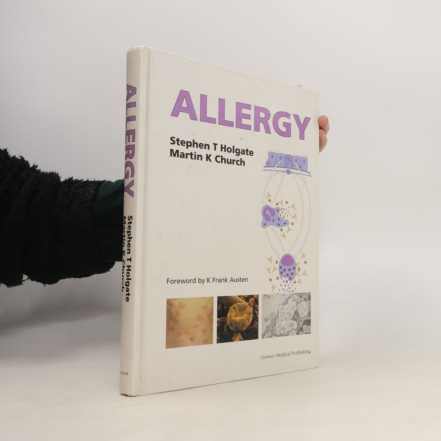 Martin K. Church Allergy