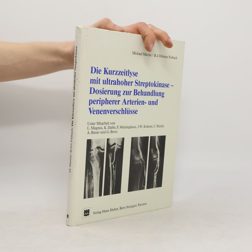 Michael Martin Die Kurzzeitlyse mit ultrahoher Streptokinase-Dosierung zur Behandlung peripherer Arterien- und Venenverschlüsse
