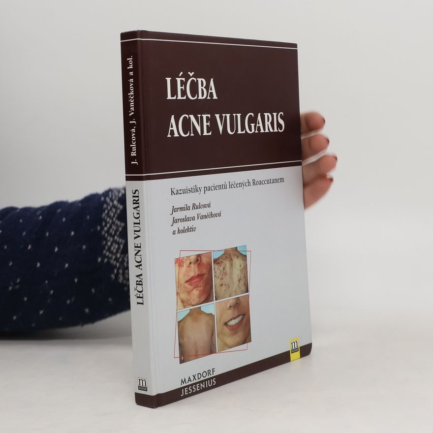 Jaroslava Vaněčková Léčba acne vulgaris
