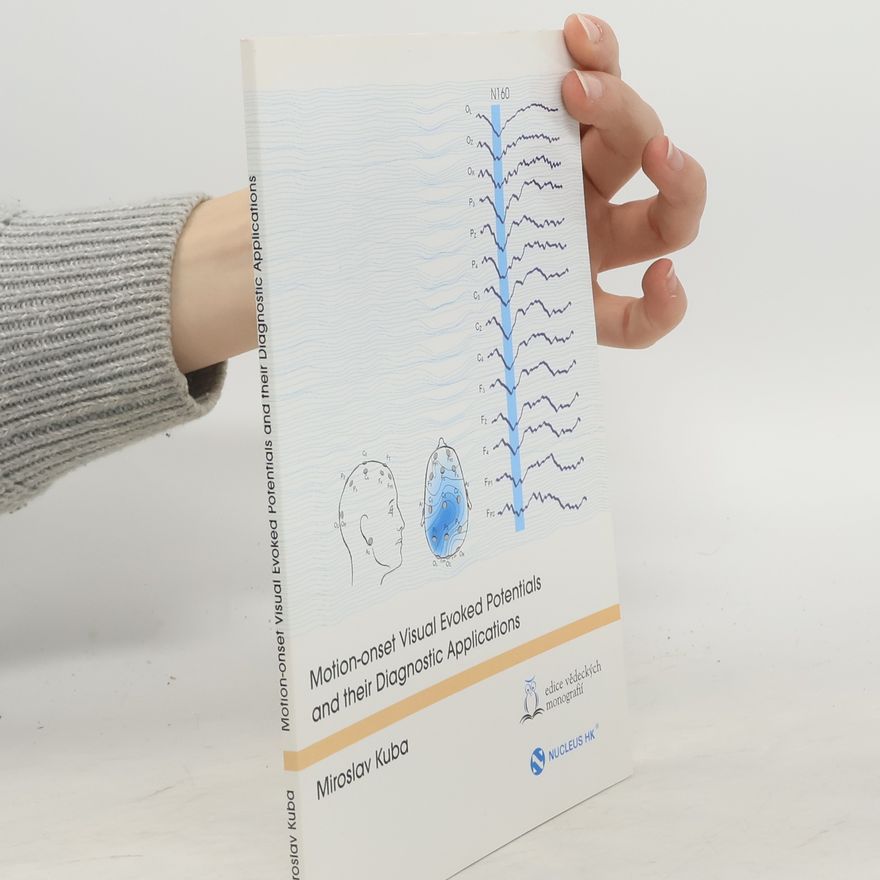 Miroslav Kuba Motion-Onset Visual Evoked Potentials and Their Diagnostic Applications