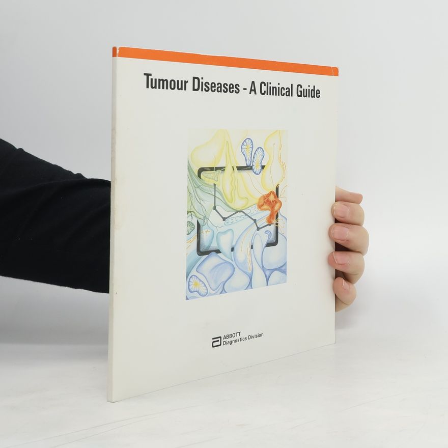 Kolektiv autorů Tumour Diseases: A Clinical Guide