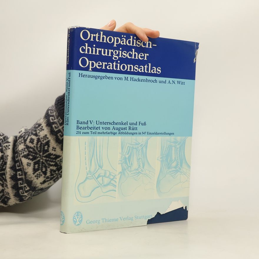 Alfred N Witt Orthopädich-chirurgischer Operationsatlas. Band V. Unterschenkel und Fuss