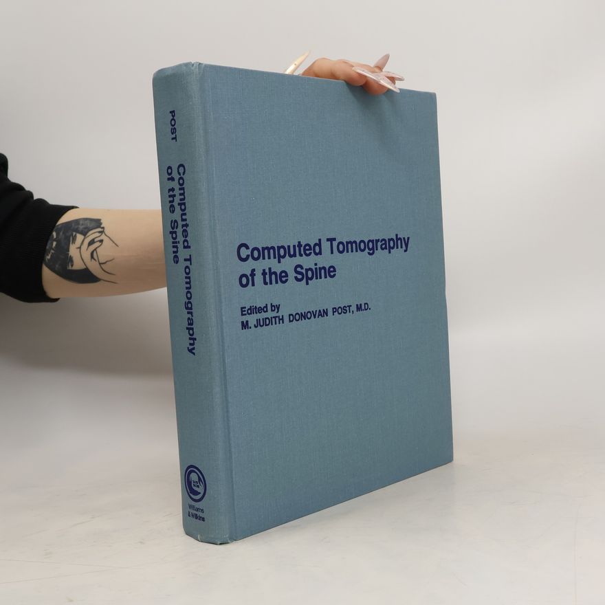 Melba Judith Donovan Computed Tomography of the Spine