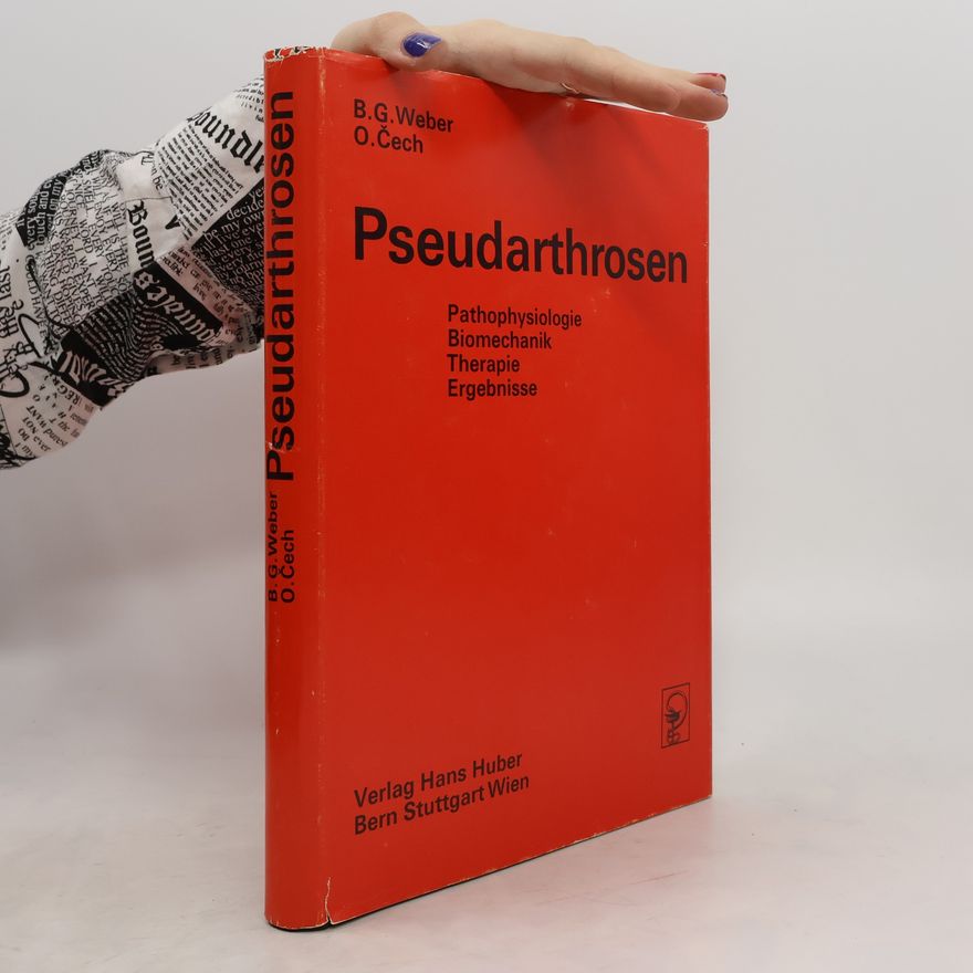 Bernhard Georg Weber Pseudarthrosen: Pathophysiologie, Biomechanik, Therapie, Ergebnisse