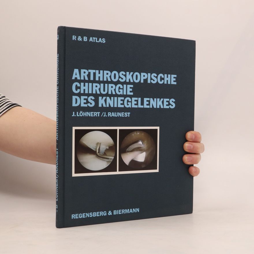 Johannes Löhnert Arthroskopische Chirurgie des Kniegelenkes
