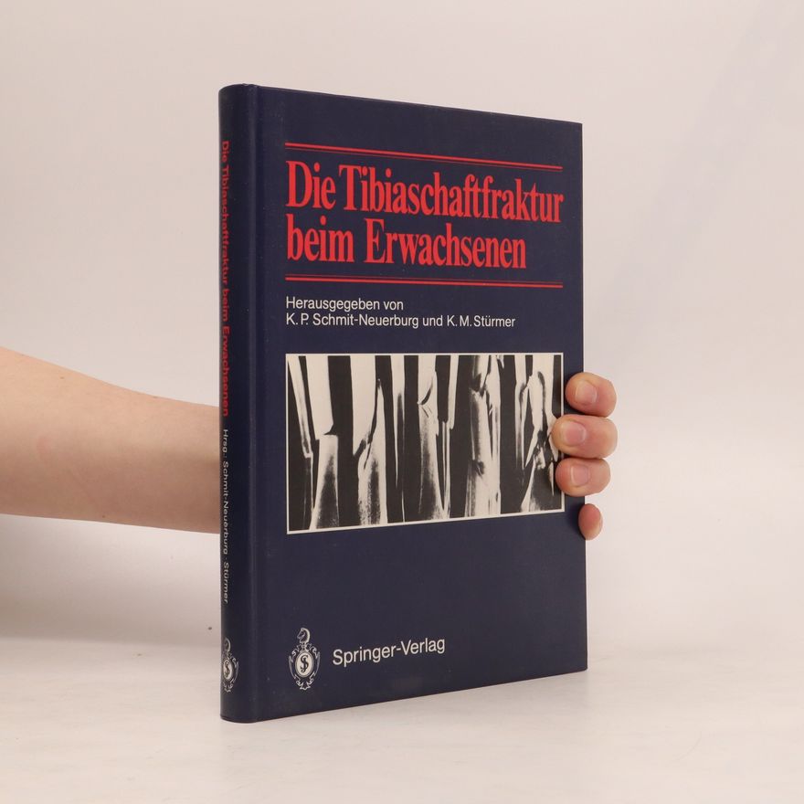 K. M. Stürmer Die Tibiaschaftfraktur beim Erwachsenen