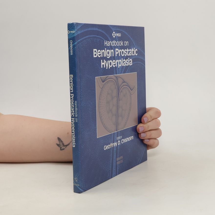 Geoffrey D. Chisholm Handbook on Benign Prostatic Hyperplasia