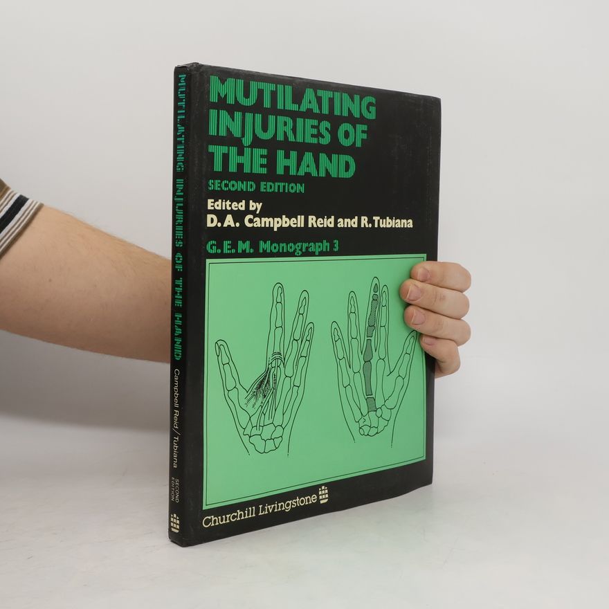R. Tubiana Mutilating Injuries of the Hand