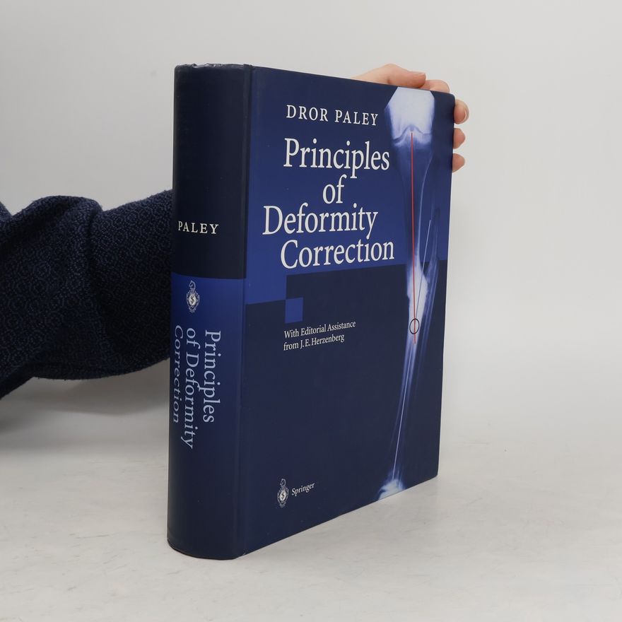 Dror Paley Principles of deformity correction