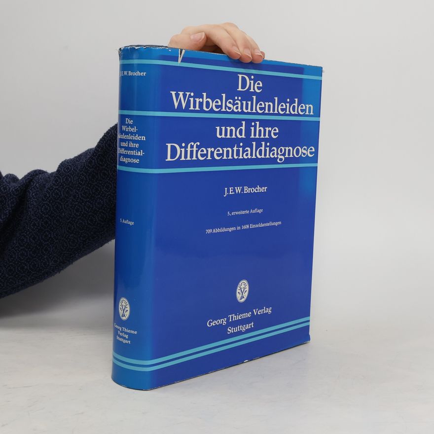 Jacques E. W. Brocher Die Wirbelsäulenleiden und ihre Differentialdiagnose