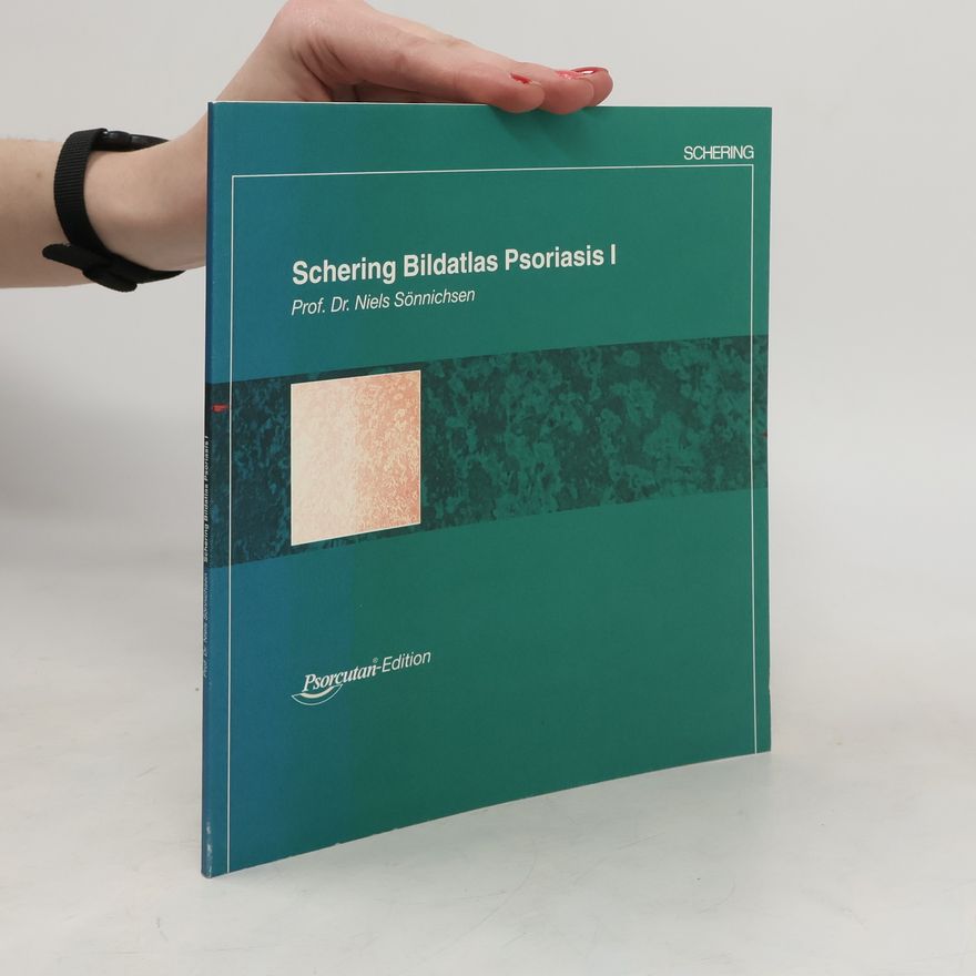 Niels Sönnichsen Schering Bildatlas Psoriasis I