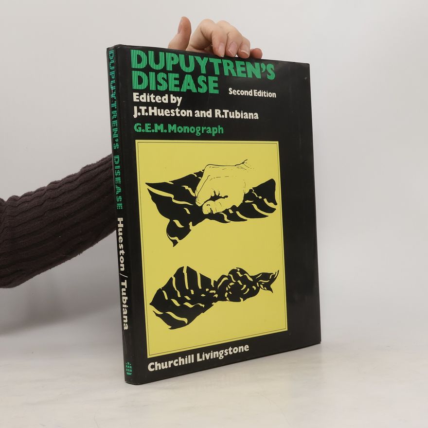 J. T. Hueston Dupuytren's Disease