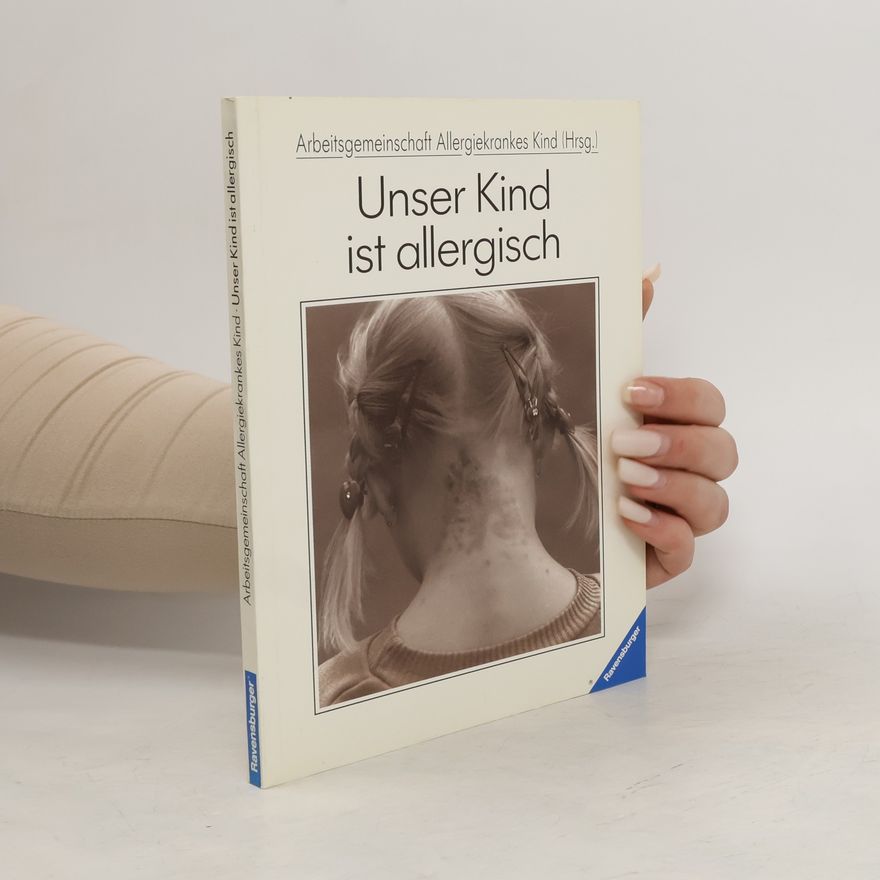 Autores varios Unser Kind ist allergisch