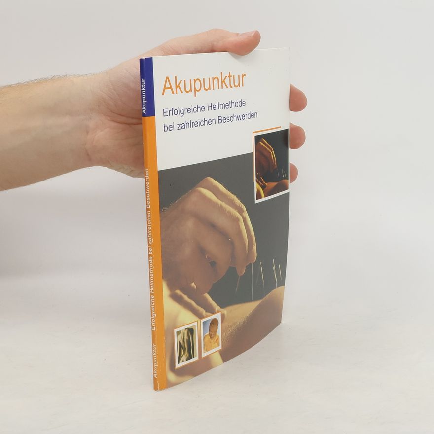 Autorenkollektiv Akupunktur. Erfolgreiche Heilmethode bei zahlreichen Beschwerden