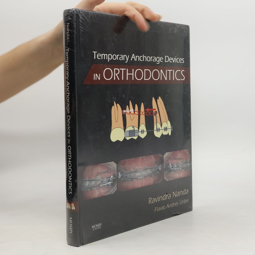 Flavio Andres Uribe Temporary Anchorage Devices in Orthodontics