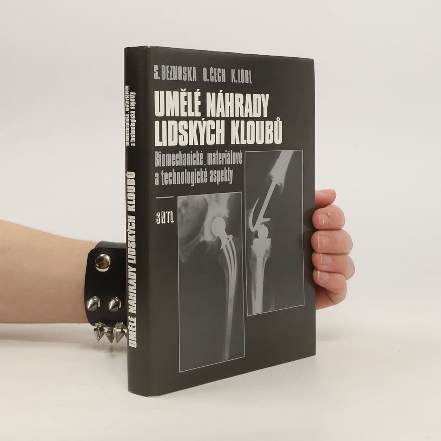 S Beznoska Umělé náhrady lidských kloubů : Biomechanické, materiálové a technologické aspekty