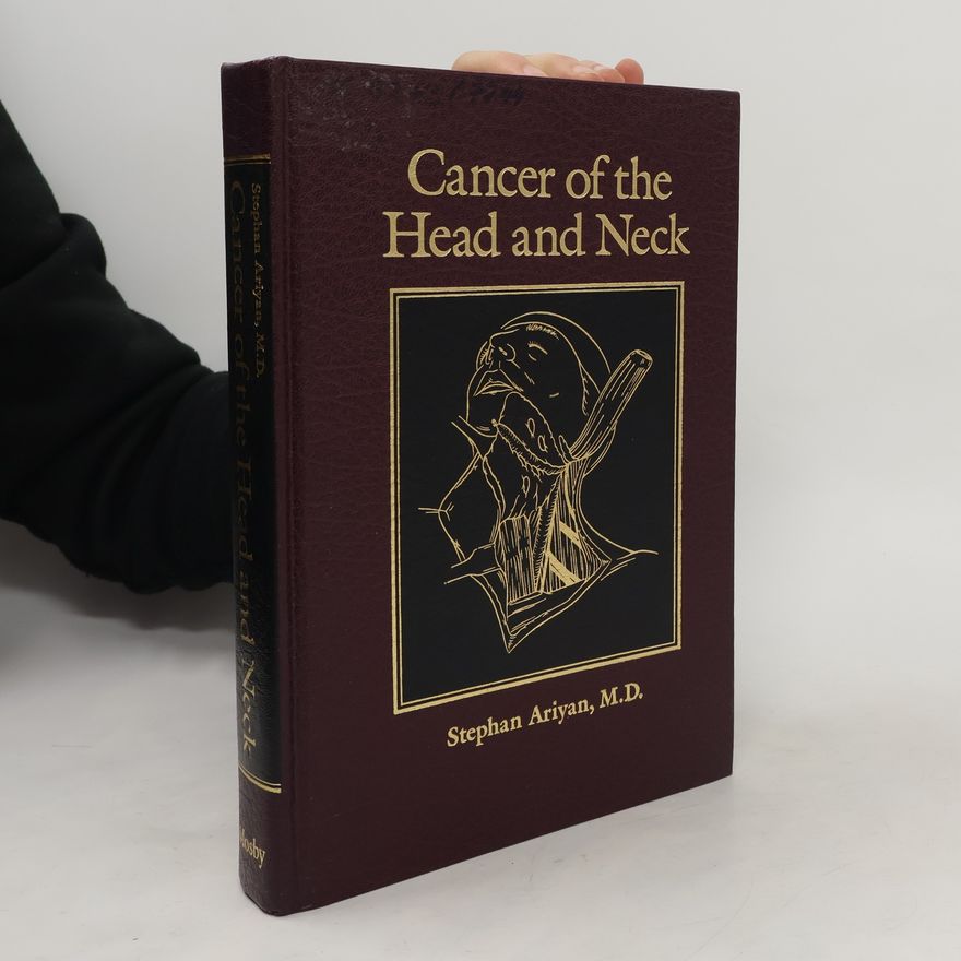 Stephan Ariyan Cancer of the head and neck