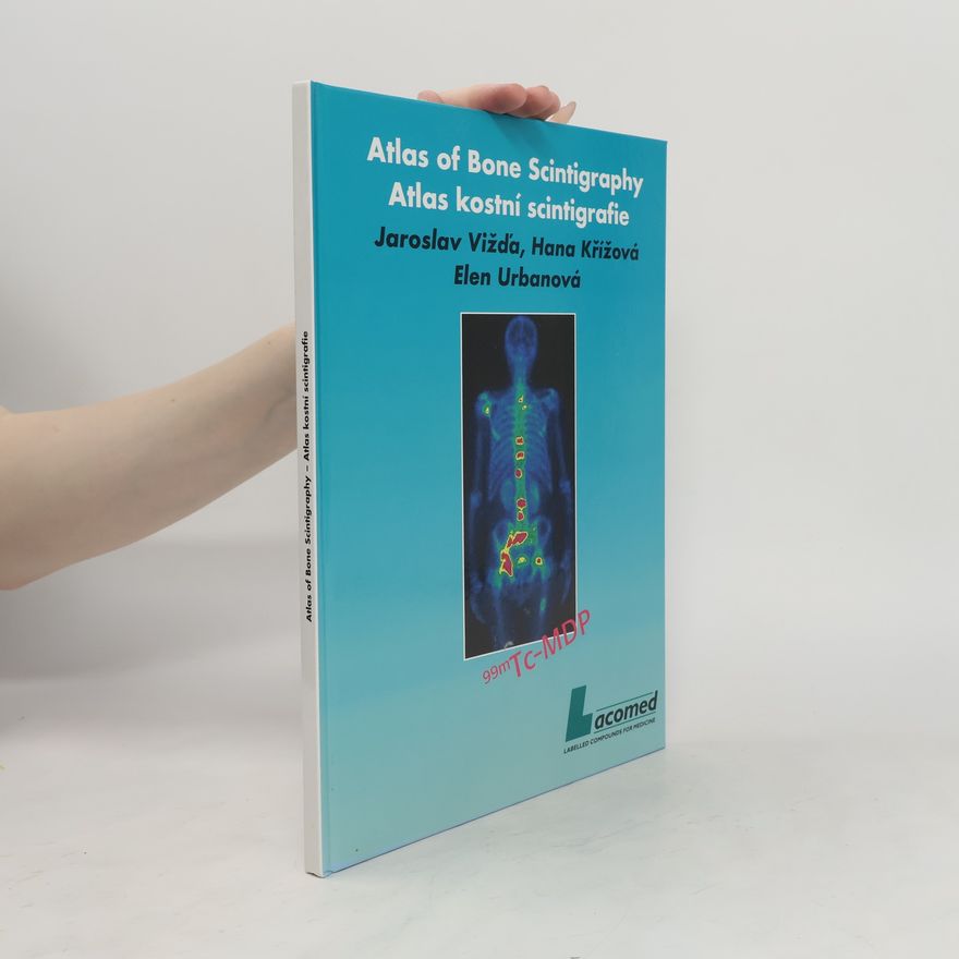 Elen Urbanová Atlas kostní scintigrafie. Atlas of Bone Scintigraphy