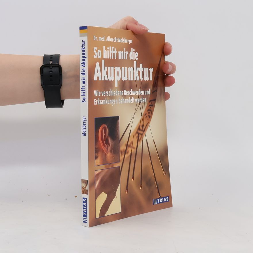 Albrecht Molsberger So hilft mir die Akupunktur