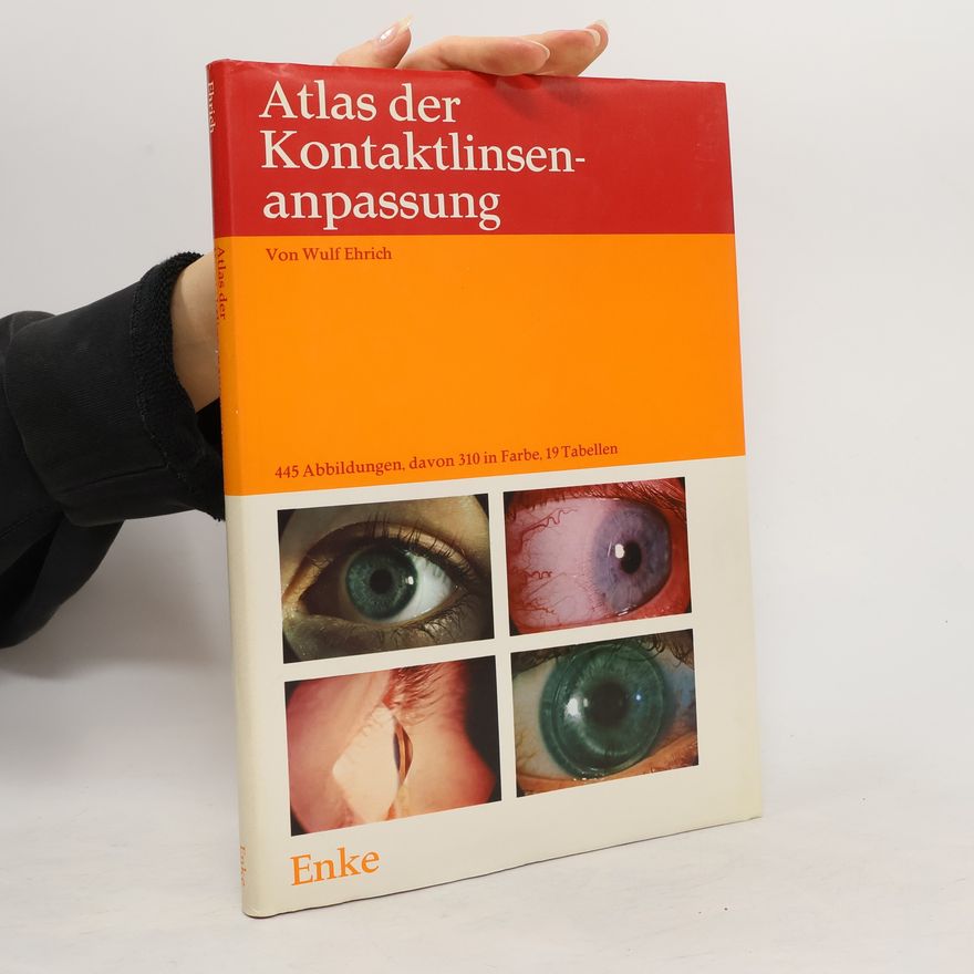 Wulf Ehrich Atlas der Kontaktlinsenanpassung
